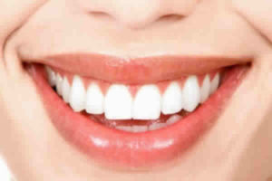 Preciso cuidar do meu sorriso, devo começar pelo plano dental?
